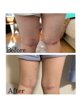 ハイケア グラン ギンザ(HYCARE GRAND GINZA)/日本ーの肌改善サロン実力/銀座