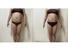 スタートフィットネス プラス エステ/ビフォーアフター