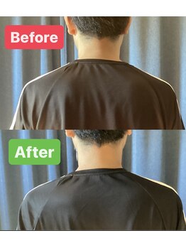 松 中目黒/【50代男性 左肩の痛み改善例】