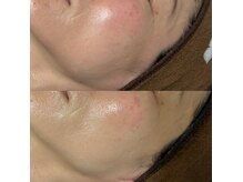 ミヨン(Miyong)/あらゆるお悩みを改善♪