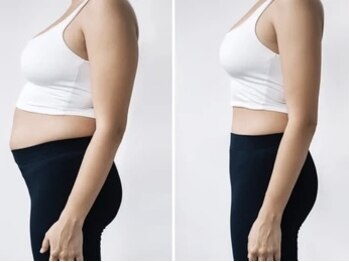 メディ(Mediiy)/ハイパーナイフ