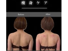 ヴィヴィアン 熊谷店(Vivian)の雰囲気（【痩身】ボディラインも整えて、結構促進デトックス）