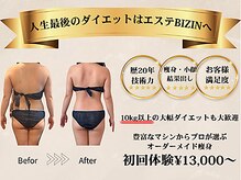 エステビジン 名古屋栄店(BIZIN)