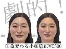 レジスタ(REGISTA)