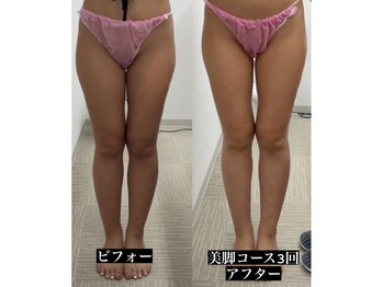 メリアミーゴ(Meli amigo)/痩身・美脚コース×3回コース