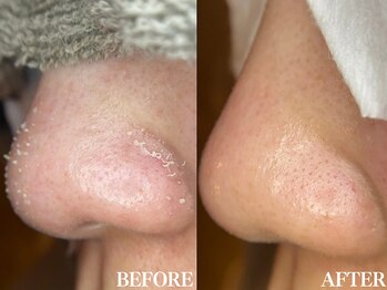 サロン ムスブ(salon MUSUBU)/山梨エステ/甲府エステ