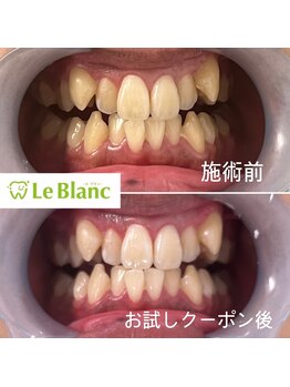 ルブラン 奈良店(Le Blanc)/ブライダルコース！