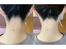 ティンク(Tink)/うなじワックス☆Before→After