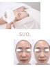 【透明感UP】くすみ・むくみ改善 光フェイシャル（パック付）¥6,900