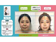 小顔整体研究所 KSラボ 鳴海店/比較写真３
