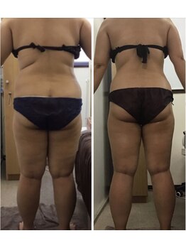 ビューティーワークスシャンティ 柏店(Beauty Works Shanti)/6ヶ月でー9.8kg！！3枚目