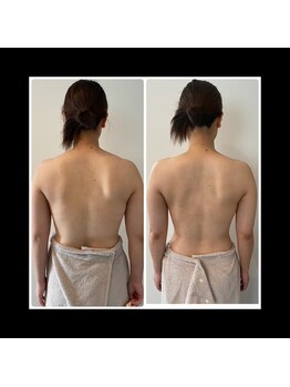 アロラヴィ(AroRavi)/ブライダルエステ