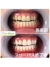 ルブラン 奈良店(Le Blanc)/やって良かったって思える！