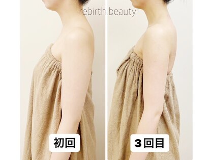 リバース 西梅田店(Rebirth)の写真
