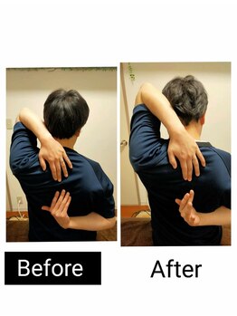 アース エンジェル整体院/ビフォアフ 肩甲骨はがし