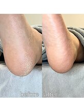 フットミー(foot mii)/