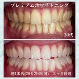 ホワイトニングビューティー 名古屋栄店(WHITENING BEAUTY)