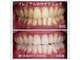 ホワイトニングビューティー 名古屋栄店(WHITENING BEAUTY)の写真