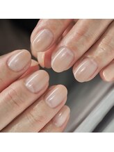 アネリー(ANERY.) 自爪育成 深爪育成