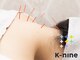 ケーナイン(K-nine)の写真/【首/肩こり/腰痛には鍼灸を♪】整体×鍼灸60分¥6980◆お悩みに合わせてオーダーメイド施術も◎根本改善へ