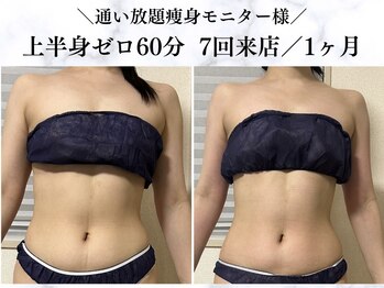 シーフェイス 横浜店(SEE FACE)/上半身ゼロダイエットモニター様