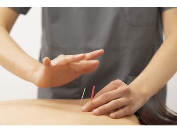 マッサージ鍼灸院つゆき按腹堂/奥の方にあるコリに届かせる鍼