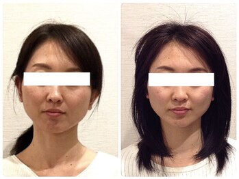 美容整体ウェリナ 中川八田院/小顔矯正/骨盤矯正/美脚サロン