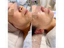 エステドブルー(Este de Bleu)/ビフォーアフター