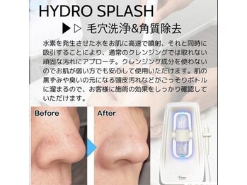 リラッシュ 岡山駅前店(Re:lash)の写真/自宅ケアでは改善しなかったいちご鼻やポツポツ毛穴に！ハイドロ毛穴洗浄で毛穴レスな美肌を実現☆