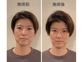 芦田整体療術院/整顔と整体でスッキリ☆