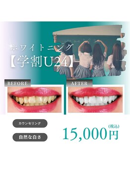 ホワイトニングショップ 大阪本町店/学割U24