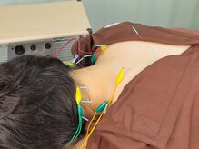 梅沢鍼灸院/鍼に電気も