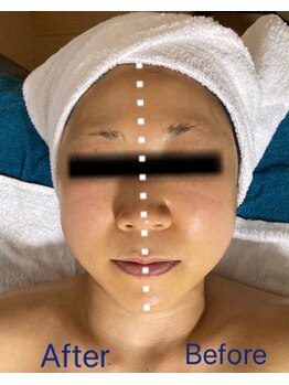 ミンク(Mink)/小顔に♪