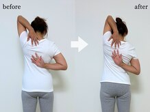 エーアール(AR)/【Before/After】