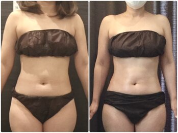 美容整体ウェリナ 名駅院/小顔矯正/骨盤矯正/美脚サロン