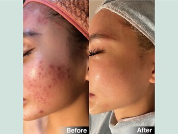 韓美 表参道店(HANMI)/