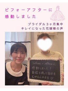 ティアラ(Tiara)/【キレイになった花嫁様の声】