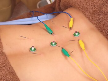 リライフ鍼灸整骨院 新橋院/鍼灸でしつこい肩こり腰痛解消へ