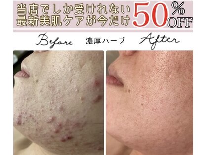 アリュール 倉敷(ALLURE)の写真