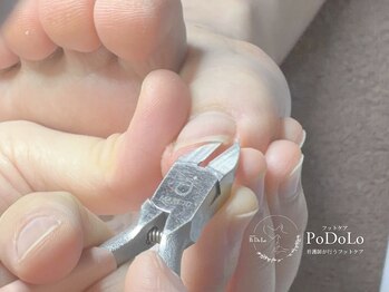 ポドロ(PoDoLo)の写真/目立たない仕上がりでマニキュアも楽しめる巻き爪補正。爪の健康を守りながら美しく整えます
