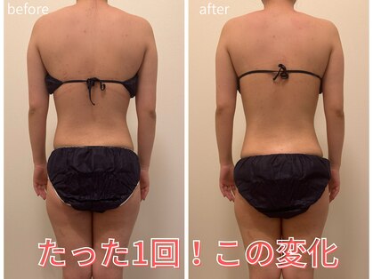 23ビューティー(23beauty)の写真