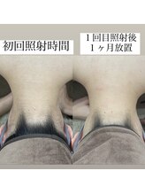 テンパ ビューティー(+10%beauty)/効果写真