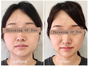 ビー バランス(Be.BALANCE)/【ダイヤモンド小顔矯正】