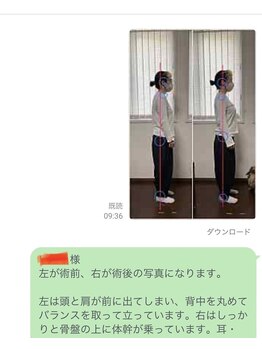 一歩堂/再評価で症状や姿勢の変化を確認