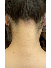 リバース(Rebirth)/うなじシェービング・ビフォー