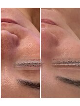 ヘアメイク エステサロン クラシカ(hairmake esthe salon clasika)/美肌作り