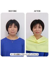 シュアリー(Surely)/トータルコースお客様