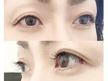 フィーネ ヴァレンテ アルプス通り店/＊施術イメージ＊