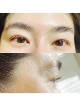 アムール(l'amour)/大人カール