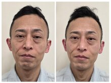 アンジェリーナの雰囲気（50代男性1回の効果/フェイシャルエステ9200円→7360円）